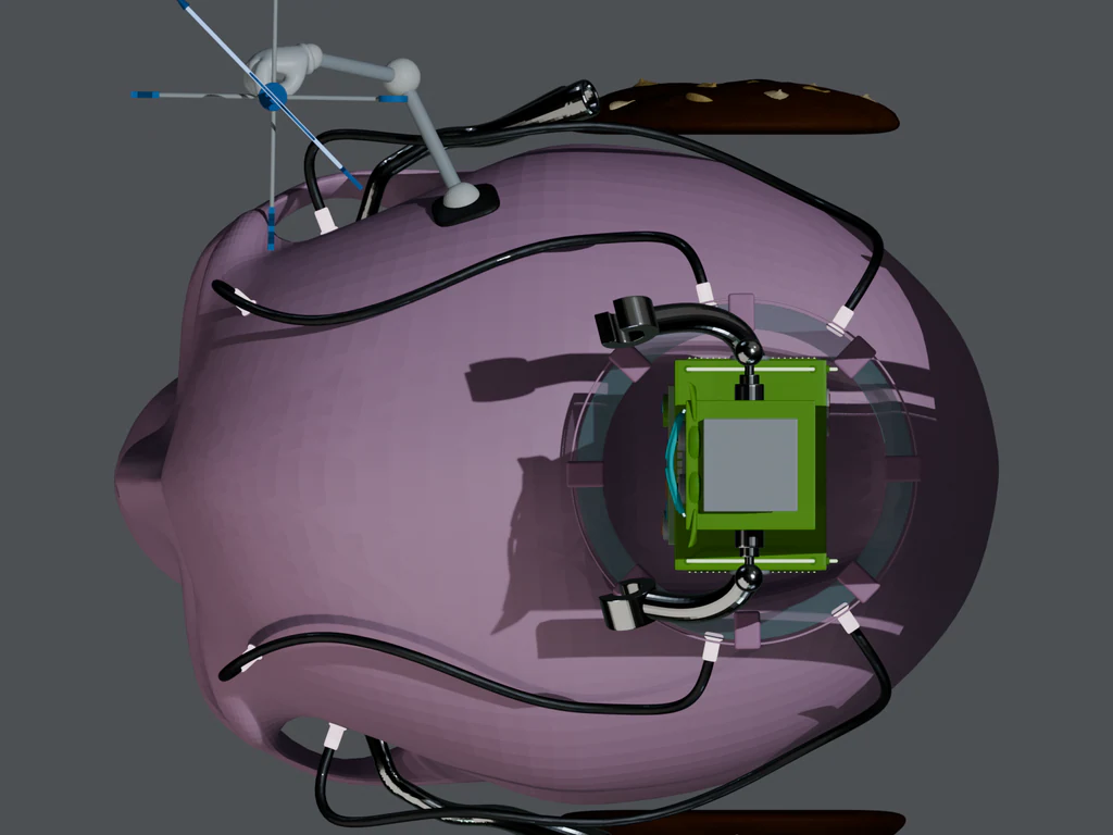 RC 78-2520 — Top detail